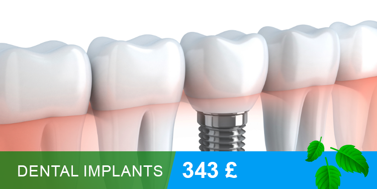 Dental Implants